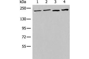 Western blot analysis of 293T cell Human metastatic malignant melanoma tissue lysates using EEA1 Polyclonal Antibody at dilution of 1:700 (EEA1 anticorps)