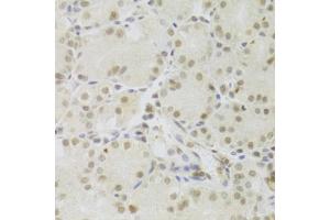 Immunohistochemistry of paraffin-embedded human stomach using PRPF3 Antibody (ABIN5973192) at dilution of 1/100 (40x lens). (PRPF3 anticorps)