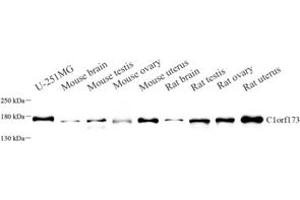 Western blot analysis of C1orf173 (ABIN7074073) at dilution of 1: 1000 (Glutamate-Rich Protein 3 (ERICH3) anticorps)