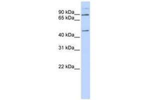 Image no. 1 for anti-Leber Congenital Amaurosis 5-Like (LCA5L) (C-Term) antibody (ABIN6740943) (LCA5L anticorps  (C-Term))