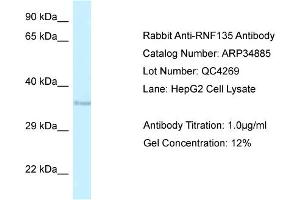 WB Suggested Anti-RNF135 Antibody   Titration: 1. (RNF135 anticorps  (Middle Region))