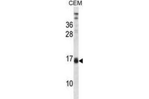 Western blot analysis in CEM cell line lysates (35ug/lane) using LALBA  Antibody . (LALBA anticorps  (Middle Region))