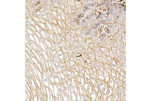 Immunohistochemistry of paraffin-embedded Human esophagus using S100 antibody (ABIN7270123) at dilution of 1:25 (40x lens). (S100A10 anticorps  (AA 1-97))