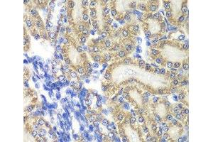 Immunohistochemistry of paraffin-embedded Rat kidney using PTGES2 Polyclonal Antibody at dilution of 1:100 (40x lens). (PTGES2 anticorps)
