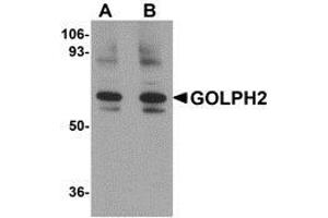 Western blot analysis of GOLPH2 in rat brain tissue lysate with AP30371PU-N GOLPH2 antibody at (A) 0. (GOLM1 anticorps  (Center))