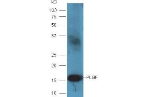 Rat placenta lysates probed with Rabbit Anti-PLGF Polyclonal Antibody, Unconjugated (ABIN727220) at 1:300 overnight at 4 °C. (PLGF anticorps  (AA 101-158))