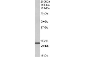 ABIN5539545 (1µg/ml) staining of Human Bone Marrow lysate (35µg protein in RIPA buffer). (IL-15 anticorps  (AA 70-82))