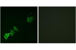 Immunofluorescence (IF) image for anti-C-Abl Oncogene 1, Non-Receptor tyrosine Kinase (ABL1) (pTyr393) antibody (ABIN2888351) (ABL1 anticorps  (pTyr393))