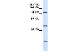 AARS antibody used at 1 ug/ml to detect target protein. (AARS anticorps  (N-Term))