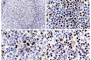 Immunohistochemical analysis of MALT1 expression in formalin-fixed human reactive lymph node. (MALT1 anticorps)