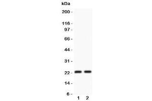 Western blot testing of CD3 epsilon antibody and Lane 1:  Jurkat (CD3 epsilon anticorps  (AA 23-207))