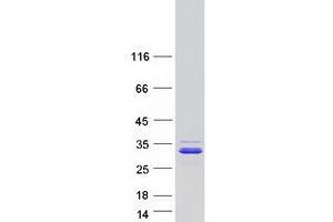 Validation with Western Blot