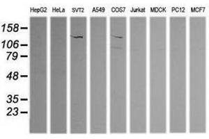 Image no. 4 for anti-Phosphoinositide-3-Kinase, Catalytic, gamma Polypeptide (PIK3CG) antibody (ABIN1500203)