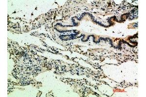 Immunohistochemical analysis of paraffin-embedded human-lung, antibody was diluted at 1:200 (THBS4 anticorps  (AA 551-600))
