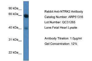 WB Suggested Anti-NTRK2  Antibody Titration: 0. (TRKB anticorps  (C-Term))