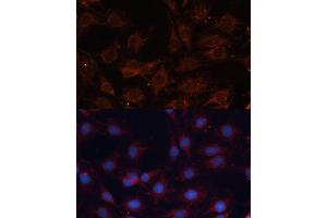 Immunofluorescence analysis of C6 cells using SLC25 antibody (ABIN6132661, ABIN6147921, ABIN6147922 and ABIN6215721) at dilution of 1:100.
