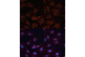 Immunofluorescence analysis of C6 cells using SLC25 antibody (ABIN6132661, ABIN6147921, ABIN6147922 and ABIN6215721) at dilution of 1:100. (SLC25A24 anticorps  (AA 1-200))