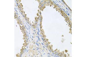 Immunohistochemistry of paraffin-embedded human prostate using HSP90AA1 antibody (ABIN6292998) at dilution of 1:100 (40x lens). (HSP90AA1 anticorps)