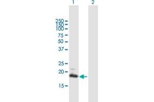 Western Blot analysis of GUCA1C expression in transfected 293T cell line by GUCA1C MaxPab polyclonal antibody. (GUCA1C anticorps  (AA 1-209))