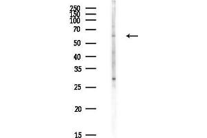 Western blot analysis of lysates from COLO205 cells(heat-shock,45 min treatment), using C1orf114 Antibody at 1/1000 dilution.