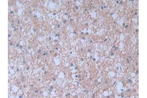 anti-Brain Natriuretic Peptide (BNP) antibody