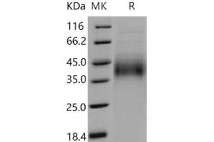Western Blotting (WB) image for Growth Hormone Receptor (GHR) (Active) protein (His tag) (ABIN7320418)