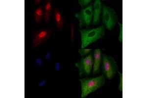 ABIN6263779 and ABIN6279623 staining  cells by IF/ICC.