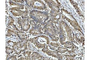 IHC analysis of ACLY using anti-ACLY antibody (ABIN4886416).
