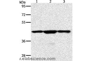 Western blot analysis of Jurkat, hela and K562 cell, using MAP2K1 Polyclonal Antibody at dilution of 1:400 (MEK1 anticorps)