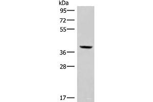 Western blot analysis of Mouse kidney tissue lysate using MEST Polyclonal Antibody at dilution of 1:350