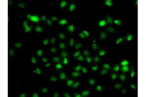 Immunofluorescence analysis of A549 cell using BCL6 antibody. (BCL6 anticorps)