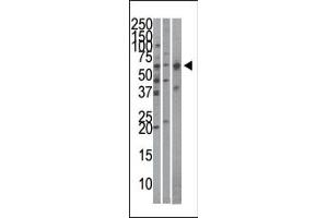 The anti-Importin alpha-3 Pab (ABIN388688 and ABIN2838720) is used in Western blot to detect Importin alpha-3 in Hela (left), mouse brain (middle), and HepG2 (right)cell line/tissue lysates. (KPNA4 anticorps  (C-Term))