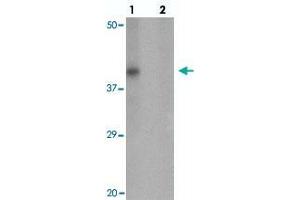 Western blot analysis of RNASET2 in SW480 cell lysate with RNASET2 polyclonal antibody  at 1 ug/mL in (lane 1) the absence and (lane 2) the presence of blocking peptide. (RNASET2 anticorps  (C-Term))