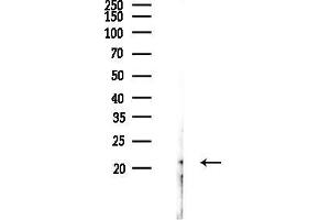anti-Adenylate Kinase 1 (AK1) (Internal Region) antibody