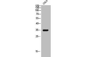 Western Blot analysis of COLO cells using GPR119 Polyclonal Antibody (G Protein-Coupled Receptor 119 anticorps  (Internal Region))