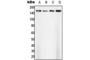 Western blot analysis of SAP155 expression in A431 (A), Ramos (B), SP2/0 (C), H9C2 (D) whole cell lysates. (SF3B1 anticorps  (N-Term))