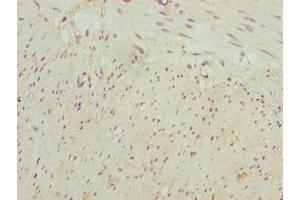 Immunohistochemistry of paraffin-embedded human colon tissue using ABIN7161250 at dilution of 1:100