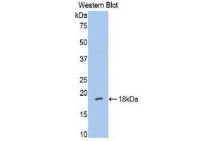 Western Blotting (WB) image for anti-Hexokinase 1 (HK1) (AA 676-800) antibody (ABIN1859173) (Hexokinase 1 anticorps  (AA 676-800))