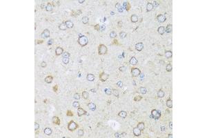 Immunohistochemistry of paraffin-embedded mouse brain using BRSK1 antibody  at dilution of 1:100 (40x lens).