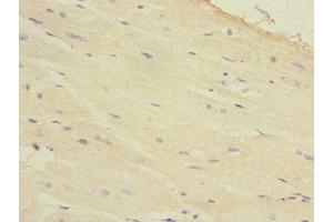Immunohistochemistry of paraffin-embedded human heart tissue using ABIN7154845 at dilution of 1:100 (HAND1 anticorps  (AA 16-215))