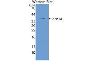 Western blot analysis of the recombinant protein. (MGLL anticorps  (AA 1-303))