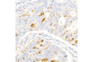 Immunohistochemistry of paraffin-embedded human tonsil using cGAS Rabbit pAb (ABIN6134073, ABIN6143590, ABIN6143591 and ABIN6224360) at dilution of 1:50 (40x lens).