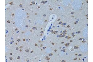 Immunohistochemistry of paraffin-embedded rat brain using PLCB1 antibody (ABIN1874160) at dilution of 1:100 (40x lens). (Phospholipase C beta 1 anticorps)