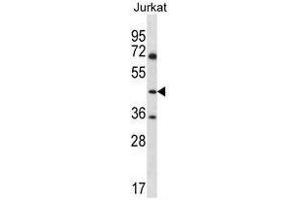 ASS1 Antibody (C-term) western blot analysis in Jurkat cell line lysates (35µg/lane). (ASS1 anticorps  (C-Term))