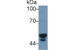Western blot analysis of Human Liver lysate, using Human CYP3A7 Antibody (1 µg/ml) and HRP-conjugated Goat Anti-Rabbit antibody ( (CYP3A7 anticorps  (AA 344-497))