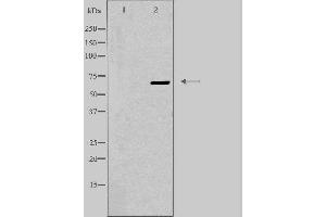 Western blot analysis of extracts from K562 cells, using EPN3 antibody.
