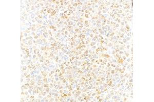 Immunohistochemistry (IHC) image for anti-Valosin Containing Protein (VCP) (C-Term) antibody (ABIN7452151) (VCP anticorps  (C-Term))