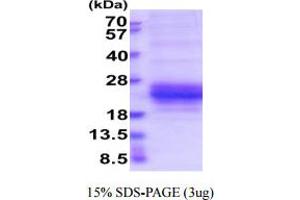 SDS-PAGE (SDS) image for Killer Cell Lectin-Like Receptor Subfamily C, Member 1 (KLRC1) (AA 94-233) protein (His tag) (ABIN6388049)
