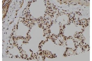 ABIN6260477 and ABIN6276706 at 1/100 staining Rat lung tissue by IHC-P. (Caspase 7 anticorps  (N-Term))