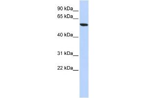 WB Suggested Anti-ZNF248 Antibody Titration:  0.